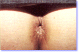 1µµ Ä¡ÇÙ